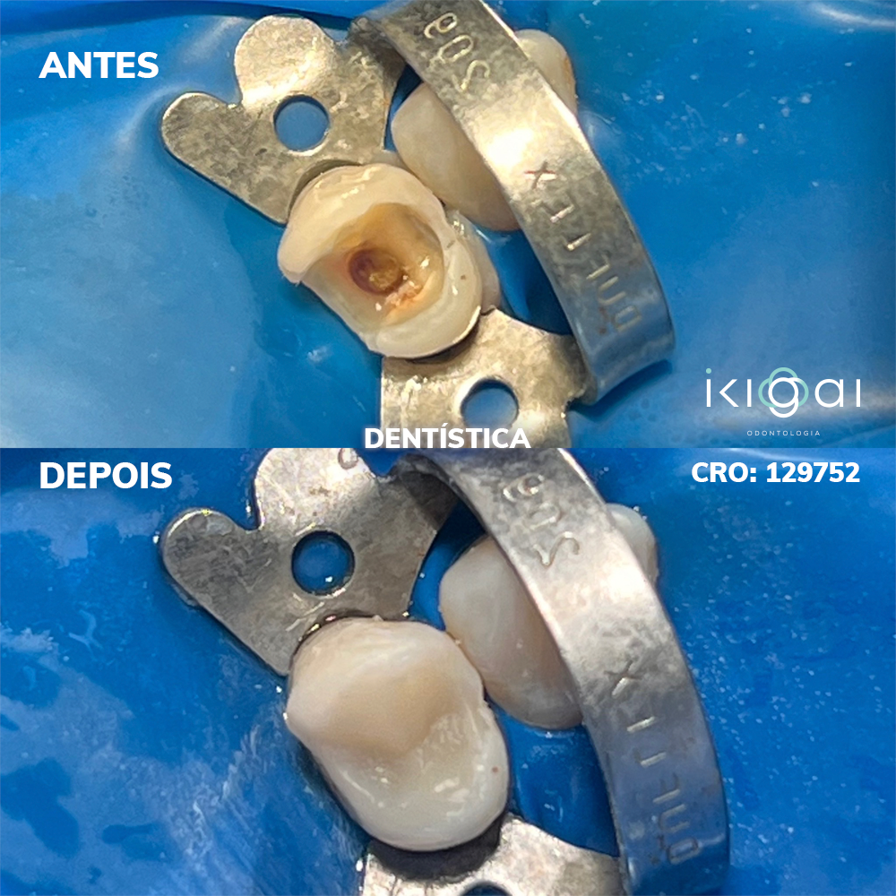 2023 – Ikigai Odontologia